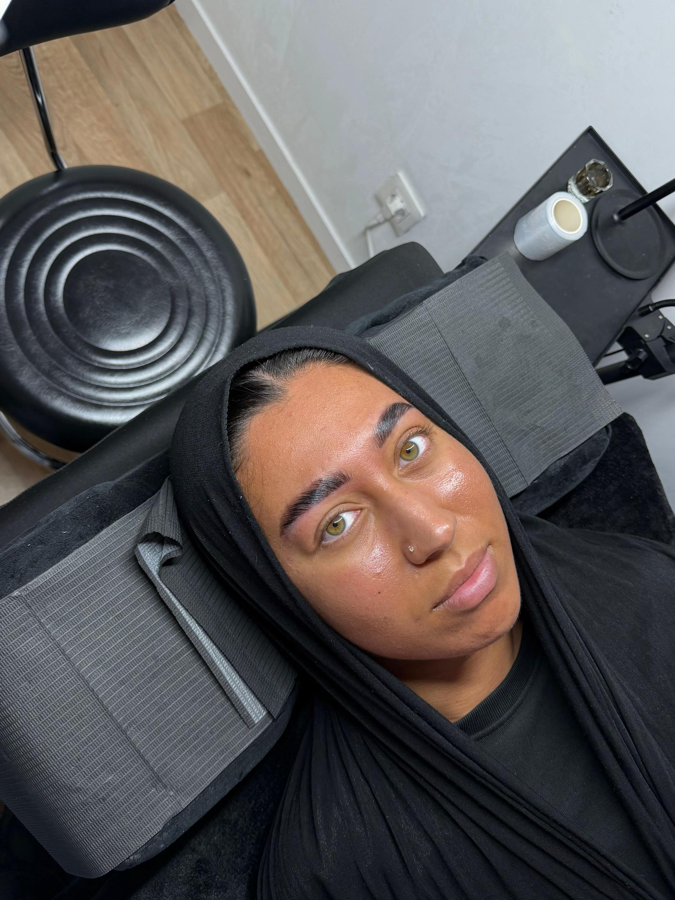 Avant/Après Browlift