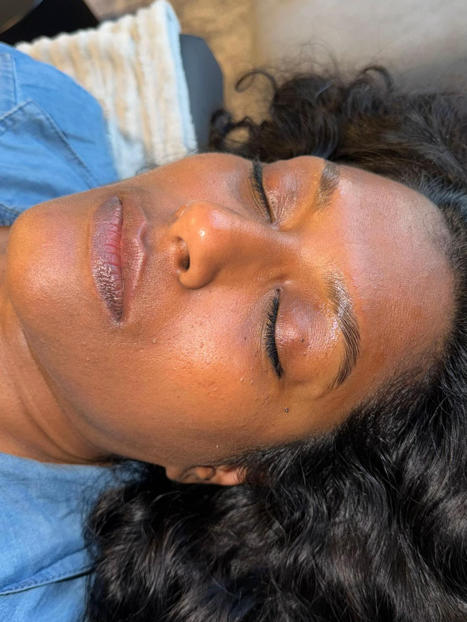 Résultat browlift